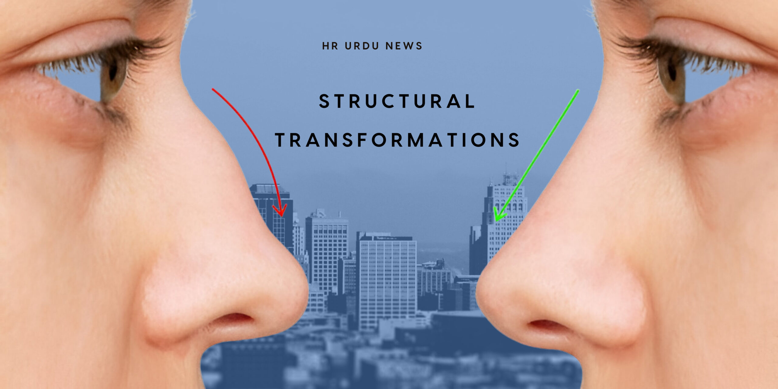 Structural Transformations